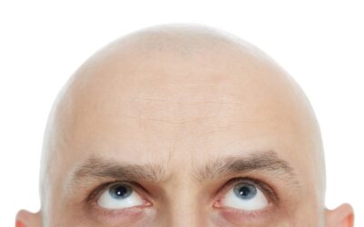 Bald men don’t buy shampoo, and other lessons in loyalty