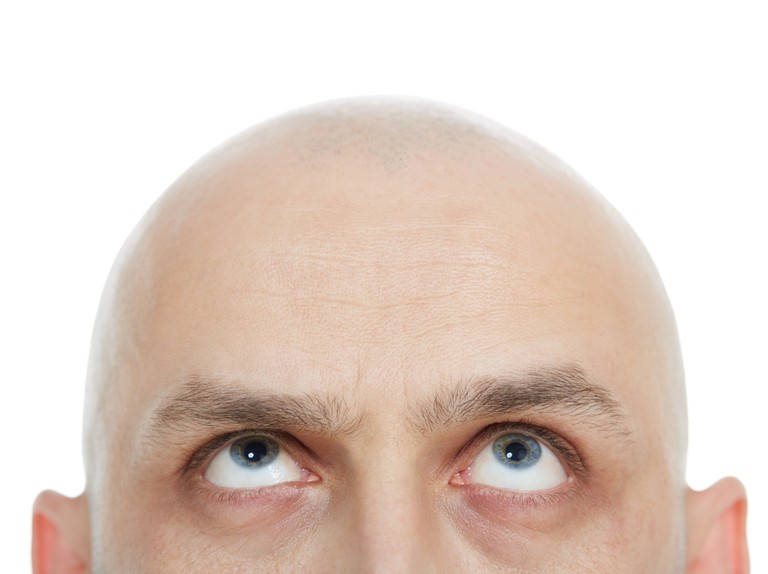 Bald men don’t buy shampoo, and other lessons in loyalty